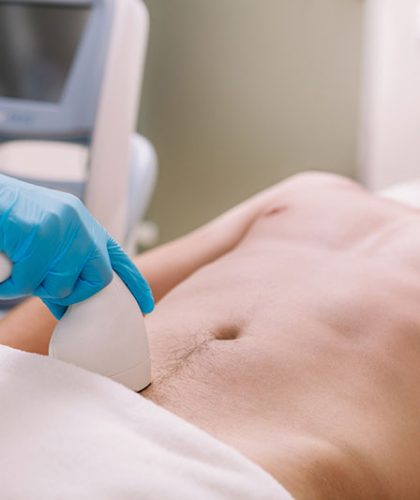 depilacao-masculina-a-laser