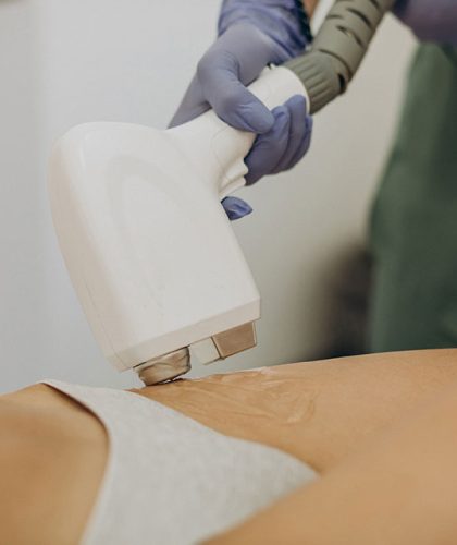laser-epilation-hair-removal-therapy (1)