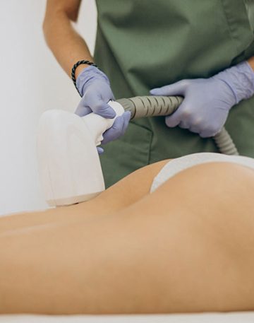 laser-para-depilar